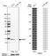 Fatty Acid Binding Protein 5 antibody, NBP2-38659, Novus Biologicals, Western Blot image 