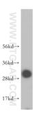 Vesicle transport through interaction with t-SNAREs homolog 1B antibody, 14495-1-AP, Proteintech Group, Western Blot image 