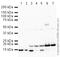 Fatty Acid Binding Protein 4 antibody, ab66682, Abcam, Western Blot image 