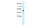 Poly(ADP-Ribose) Polymerase Family Member 6 antibody, 27-942, ProSci, Western Blot image 