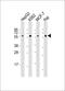 Cell Division Cycle 25C antibody, M01343-2, Boster Biological Technology, Western Blot image 
