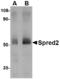 Sprouty Related EVH1 Domain Containing 2 antibody, LS-C82864, Lifespan Biosciences, Western Blot image 