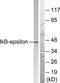 NFKB Inhibitor Epsilon antibody, TA314256, Origene, Western Blot image 
