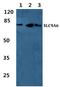 Solute Carrier Family 9 Member A6 antibody, A05023, Boster Biological Technology, Western Blot image 