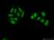 SAT antibody, 14708-1-AP, Proteintech Group, Immunofluorescence image 