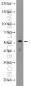 Zinc Finger Protein 140 antibody, 24531-1-AP, Proteintech Group, Western Blot image 