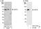 Zeta Chain Of T Cell Receptor Associated Protein Kinase 70 antibody, A301-818A, Bethyl Labs, Immunoprecipitation image 