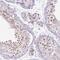 Elongin A3 antibody, HPA050086, Atlas Antibodies, Immunohistochemistry paraffin image 