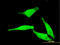 5'-Nucleotidase, Cytosolic II antibody, LS-C133696, Lifespan Biosciences, Immunofluorescence image 