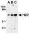 Interferon-induced, double-stranded RNA-activated protein kinase antibody, TA306356, Origene, Western Blot image 