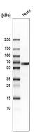 WAS protein family homolog 1 antibody, HPA002689, Atlas Antibodies, Western Blot image 