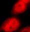 DEAD-Box Helicase 17 antibody, FNab02296, FineTest, Immunofluorescence image 