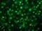 Methyl-CpG Binding Protein 2 antibody, NBP2-50060, Novus Biologicals, Immunocytochemistry image 