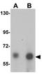 Ankyrin Repeat And LEM Domain Containing 1 antibody, GTX32043, GeneTex, Western Blot image 
