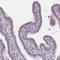 MB1 antibody, HPA049518, Atlas Antibodies, Immunohistochemistry paraffin image 