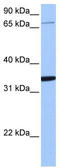 Protocadherin Alpha 10 antibody, TA331056, Origene, Western Blot image 
