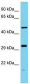 Acidic Residue Methyltransferase 1 antibody, TA330735, Origene, Western Blot image 