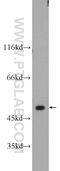 Histone-lysine N-methyltransferase SETD7 antibody, 24840-1-AP, Proteintech Group, Western Blot image 