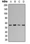 DNA Polymerase Gamma 2, Accessory Subunit antibody, LS-C358240, Lifespan Biosciences, Western Blot image 
