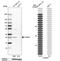 Cytochrome b reductase 1 antibody, NBP1-84291, Novus Biologicals, Western Blot image 
