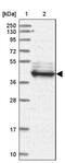 Leucine Rich Repeat Containing 2 antibody, NBP1-85853, Novus Biologicals, Western Blot image 