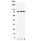 Discoidin Domain Receptor Tyrosine Kinase 1 antibody, R30978, NSJ Bioreagents, Western Blot image 