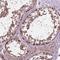 Nudix Hydrolase 1 antibody, HPA012636, Atlas Antibodies, Immunohistochemistry paraffin image 