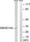 Abhydrolase Domain Containing 14A antibody, GTX87114, GeneTex, Western Blot image 