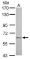 PTA antibody, NBP2-16404, Novus Biologicals, Western Blot image 