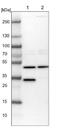 Citrate Lyase Beta Like antibody, NBP1-84454, Novus Biologicals, Western Blot image 