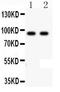 Cadherin 17 antibody, LS-C313300, Lifespan Biosciences, Western Blot image 