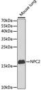 NPC Intracellular Cholesterol Transporter 2 antibody, 19-648, ProSci, Western Blot image 