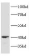 Developmentally Regulated GTP Binding Protein 1 antibody, FNab02537, FineTest, Western Blot image 
