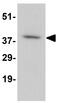 Atypical Chemokine Receptor 1 (Duffy Blood Group) antibody, GTX16988, GeneTex, Western Blot image 