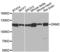 Dynamin 2 antibody, LS-C335096, Lifespan Biosciences, Western Blot image 