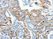 Actin Filament Associated Protein 1 antibody, CSB-PA098902, Cusabio, Immunohistochemistry paraffin image 