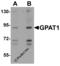 Glycerol-3-Phosphate Acyltransferase, Mitochondrial antibody, 4613, ProSci, Western Blot image 