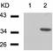 Cyclin Dependent Kinase 6 antibody, TA323940, Origene, Western Blot image 