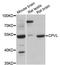 Probable serine carboxypeptidase CPVL antibody, abx125713, Abbexa, Western Blot image 