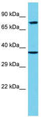 Epsin-3 antibody, TA333763, Origene, Western Blot image 