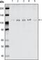 EPHB1 antibody, GTX83049, GeneTex, Western Blot image 