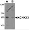 Potassium channel subfamily K member 13 antibody, 6423, ProSci, Western Blot image 