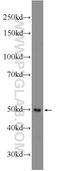 Ankyrin Repeat Domain 13D antibody, 21100-1-AP, Proteintech Group, Western Blot image 