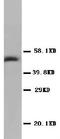 Deoxyuridine Triphosphatase antibody, PA1030, Boster Biological Technology, Western Blot image 