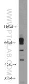Inducible T Cell Costimulator Ligand antibody, 14922-1-AP, Proteintech Group, Western Blot image 