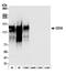 TNF Receptor Superfamily Member 8 antibody, A700-055, Bethyl Labs, Western Blot image 