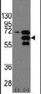 Internexin Neuronal Intermediate Filament Protein Alpha antibody, PA5-13283, Invitrogen Antibodies, Western Blot image 