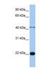 Chromosome 2 Open Reading Frame 68 antibody, NBP1-70469, Novus Biologicals, Western Blot image 