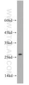 Probable RNA-binding protein EIF1AD antibody, 20528-1-AP, Proteintech Group, Western Blot image 
