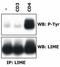 Lck-interacting transmembrane adapter 1 antibody, SM3137P, Origene, Western Blot image 